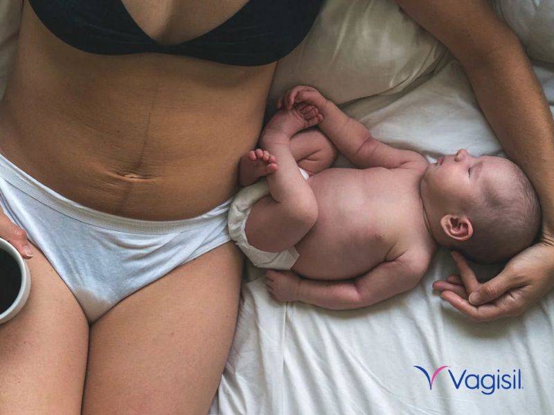 dung dịch vệ sinh phụ nữ sau sinh