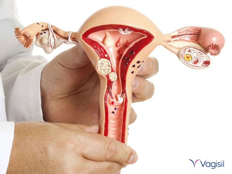 ph dung dịch vệ sinh phụ nữ